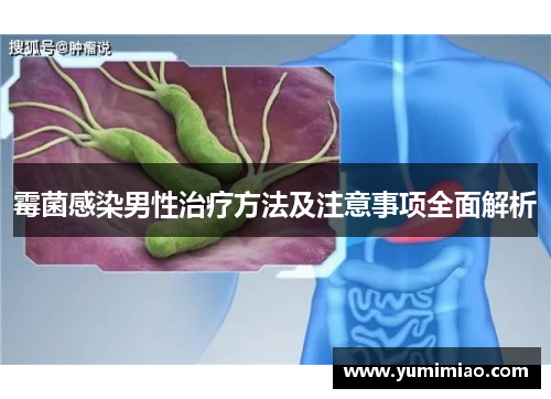 霉菌感染男性治疗方法及注意事项全面解析