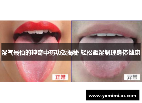 湿气最怕的神奇中药功效揭秘 轻松驱湿调理身体健康